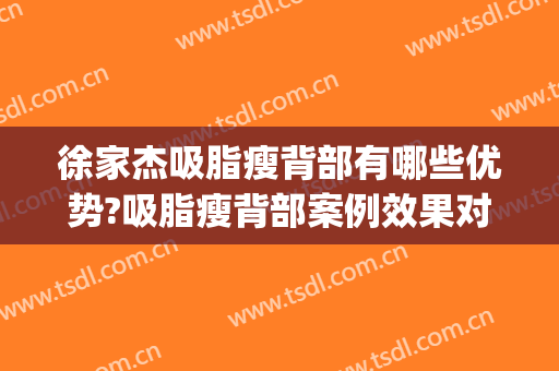 徐家杰吸脂瘦背部有哪些优势?吸脂瘦背部案例效果对比图_中国医学科学院整形外科医院