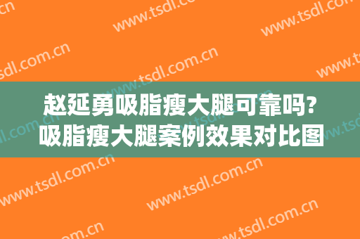 赵延勇吸脂瘦大腿可靠吗?吸脂瘦大腿案例效果对比图_中国医学科学院整形外科医院