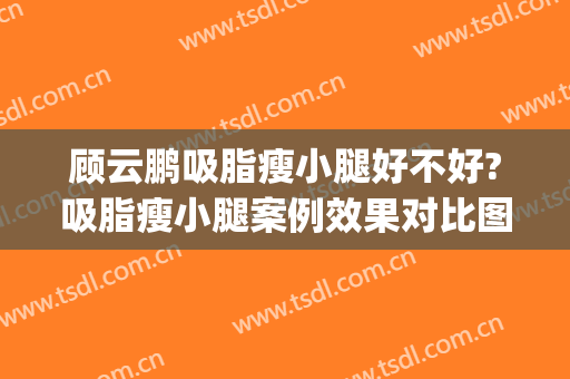 顾云鹏吸脂瘦小腿好不好?吸脂瘦小腿案例效果对比图_中国医学科学院整形外科医院