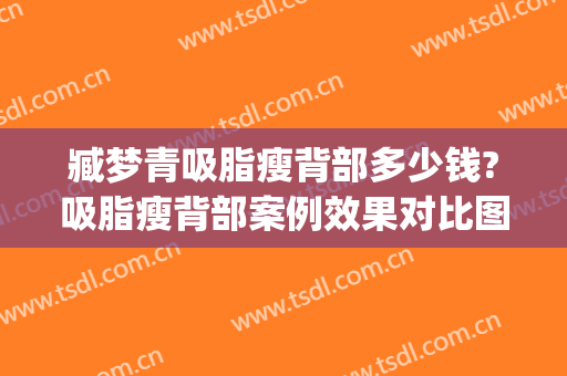 臧梦青吸脂瘦背部多少钱?吸脂瘦背部案例效果对比图_中国医学科学院整形外科医院