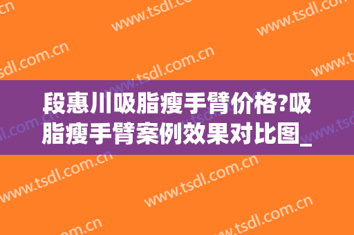 段惠川吸脂瘦手臂价格?吸脂瘦手臂案例效果对比图_上海交通大学医学院附属第九人民医院