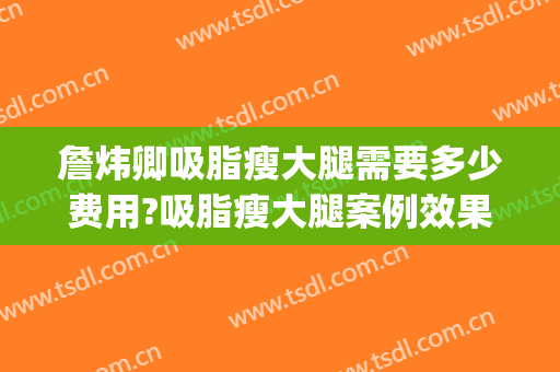 詹炜卿吸脂瘦大腿需要多少费用?吸脂瘦大腿案例效果对比图_广州医科大学附属第三医院