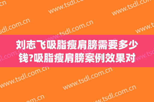刘志飞吸脂瘦肩膀需要多少钱?吸脂瘦肩膀案例效果对比图_中国医学科学院北京协和医院