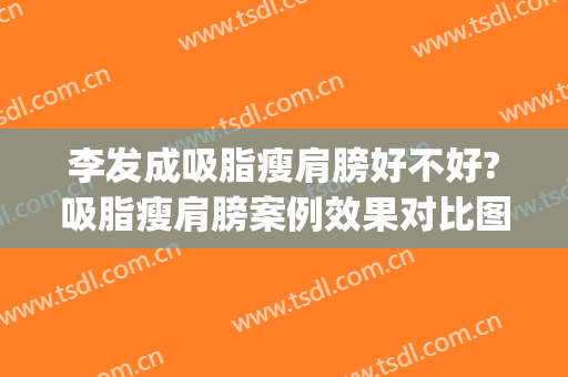 李发成吸脂瘦肩膀好不好?吸脂瘦肩膀案例效果对比图_中国医学科学院整形外科医院
