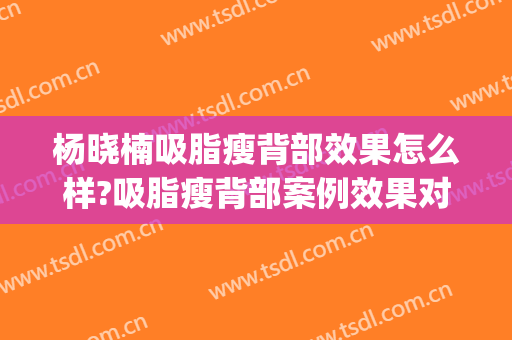 杨晓楠吸脂瘦背部效果怎么样?吸脂瘦背部案例效果对比图_中国医学科学院整形外科医院