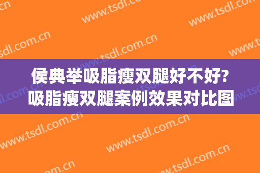 侯典举吸脂瘦双腿好不好?吸脂瘦双腿案例效果对比图_中国医学科学院整形外科医院