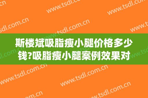 斯楼斌吸脂瘦小腿价格多少钱?吸脂瘦小腿案例效果对比图_中国医学科学院北京协和医院