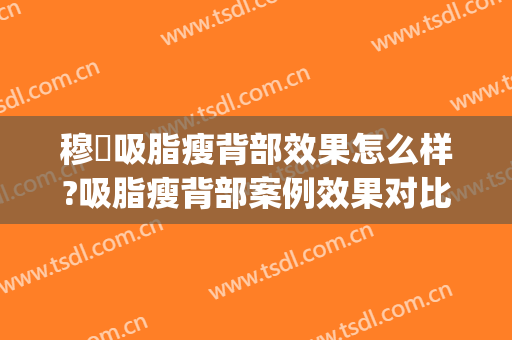 穆籣吸脂瘦背部效果怎么样?吸脂瘦背部案例效果对比图_北京大学人民医院