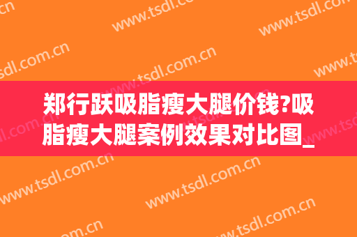 郑行跃吸脂瘦大腿价钱?吸脂瘦大腿案例效果对比图_好大夫工作室(大腿吸脂价格)
