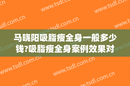 马晓阳吸脂瘦全身一般多少钱?吸脂瘦全身案例效果对比图_中国医学科学院整形外科医院