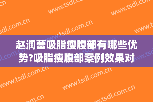 赵润蕾吸脂瘦腹部有哪些优势?吸脂瘦腹部案例效果对比图_北京大学第三医院