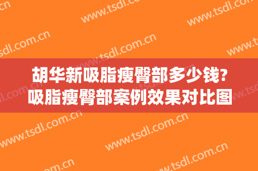 胡华新吸脂瘦臀部多少钱?吸脂瘦臀部案例效果对比图_北京大学深圳医院