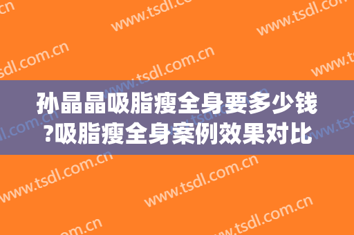 孙晶晶吸脂瘦全身要多少钱?吸脂瘦全身案例效果对比图_中国医学科学院整形外科医院