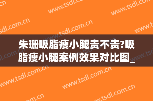 朱珊吸脂瘦小腿贵不贵?吸脂瘦小腿案例效果对比图_中国医学科学院整形外科医院