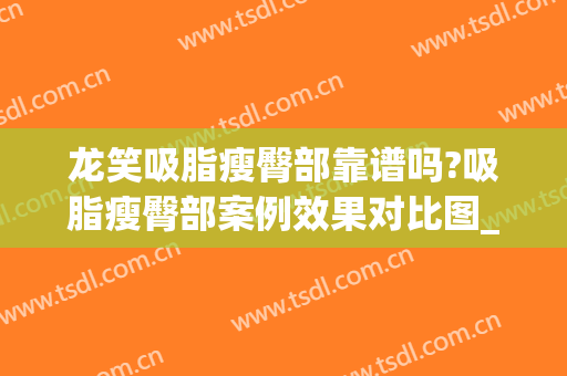 龙笑吸脂瘦臀部靠谱吗?吸脂瘦臀部案例效果对比图_中国医学科学院北京协和医院