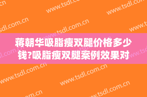 蒋朝华吸脂瘦双腿价格多少钱?吸脂瘦双腿案例效果对比图_上海交通大学医学院附属第九人民医院