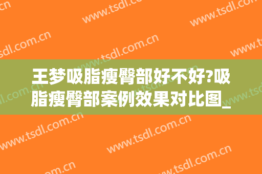 王梦吸脂瘦臀部好不好?吸脂瘦臀部案例效果对比图_中国医学科学院整形外科医院