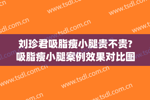 刘珍君吸脂瘦小腿贵不贵?吸脂瘦小腿案例效果对比图_中国医学科学院整形外科医院