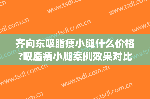 齐向东吸脂瘦小腿什么价格?吸脂瘦小腿案例效果对比图_南方医科大学珠江医院