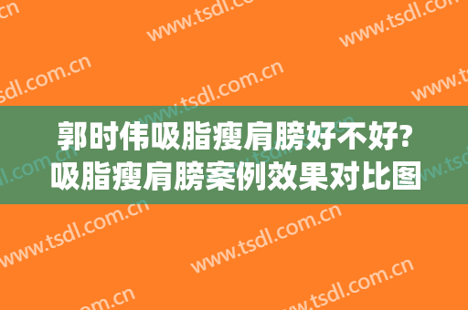 郭时伟吸脂瘦肩膀好不好?吸脂瘦肩膀案例效果对比图_中国医学科学院整形外科医院