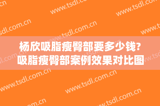 杨欣吸脂瘦臀部要多少钱?吸脂瘦臀部案例效果对比图_中国医学科学院整形外科医院