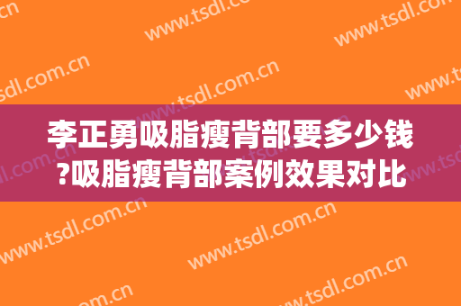 李正勇吸脂瘦背部要多少钱?吸脂瘦背部案例效果对比图_四川大学华西医院