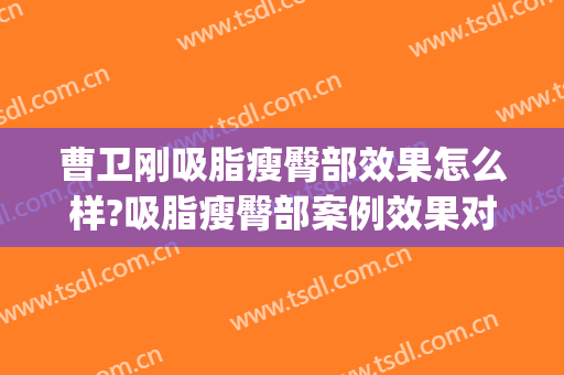曹卫刚吸脂瘦臀部效果怎么样?吸脂瘦臀部案例效果对比图_上海交通大学医学院附属第九人民医院