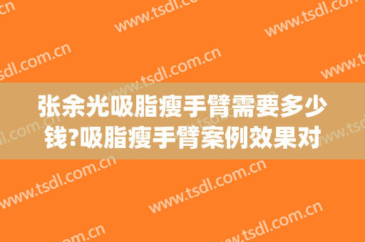 张余光吸脂瘦手臂需要多少钱?吸脂瘦手臂案例效果对比图_上海交通大学医学院附属第九人民医院