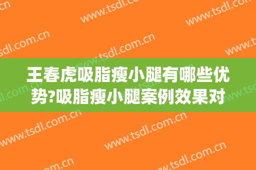 王春虎吸脂瘦小腿有哪些优势?吸脂瘦小腿案例效果对比图_中国医学科学院整形外科医院