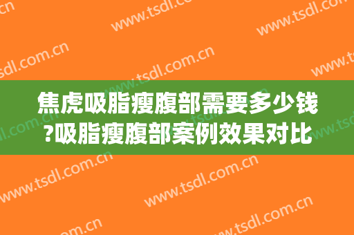 焦虎吸脂瘦腹部需要多少钱?吸脂瘦腹部案例效果对比图_中国医学科学院整形外科医院