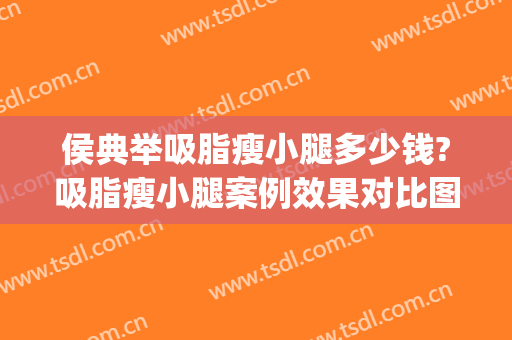 侯典举吸脂瘦小腿多少钱?吸脂瘦小腿案例效果对比图_中国医学科学院整形外科医院