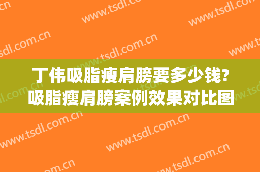 丁伟吸脂瘦肩膀要多少钱?吸脂瘦肩膀案例效果对比图_上海交通大学医学院附属第九人民医院