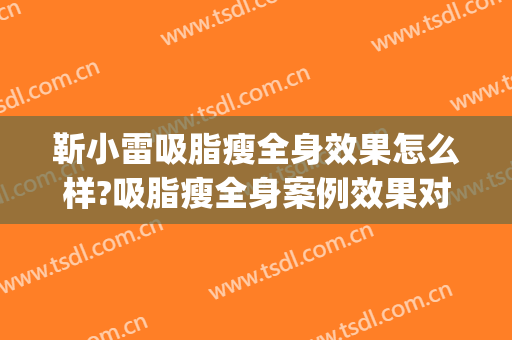 靳小雷吸脂瘦全身效果怎么样?吸脂瘦全身案例效果对比图_中国医学科学院整形外科医院