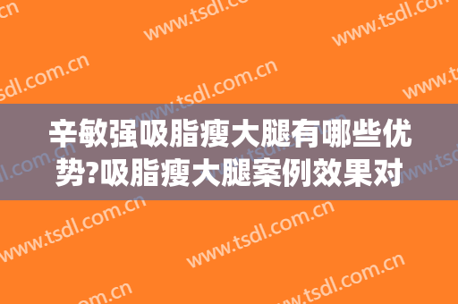 辛敏强吸脂瘦大腿有哪些优势?吸脂瘦大腿案例效果对比图_中国医学科学院整形外科医院
