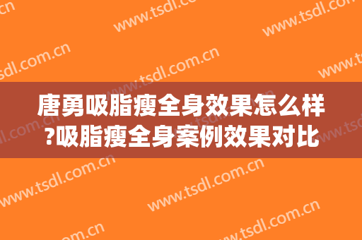 唐勇吸脂瘦全身效果怎么样?吸脂瘦全身案例效果对比图_中国医学科学院整形外科医院