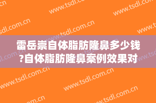 雷岳崇自体脂肪隆鼻多少钱?自体脂肪隆鼻案例效果对比图_好大夫工作室