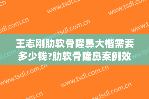 王志刚肋软骨隆鼻大楷需要多少钱?肋软骨隆鼻案例效果对比图_好大夫工作室