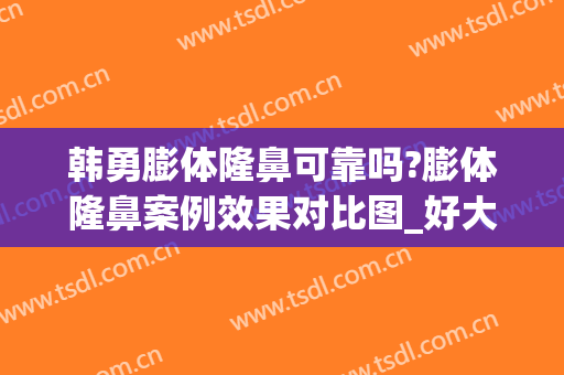 韩勇膨体隆鼻可靠吗?膨体隆鼻案例效果对比图_好大夫工作室(膨体隆鼻真实案例)