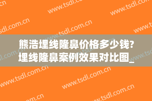 熊浩埋线隆鼻价格多少钱?埋线隆鼻案例效果对比图_雅安市人民医院