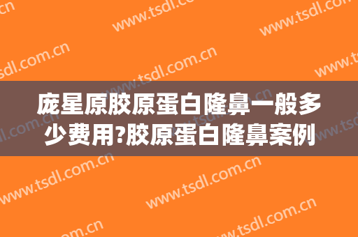 庞星原胶原蛋白隆鼻一般多少费用?胶原蛋白隆鼻案例效果对比图_武汉市第三医院