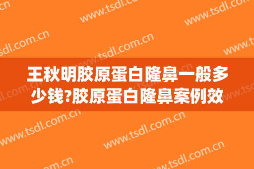 王秋明胶原蛋白隆鼻一般多少钱?胶原蛋白隆鼻案例效果对比图_衢州市人民医院