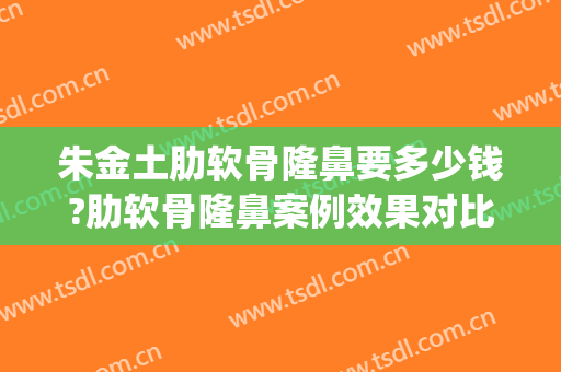 朱金土肋软骨隆鼻要多少钱?肋软骨隆鼻案例效果对比图_好大夫工作室