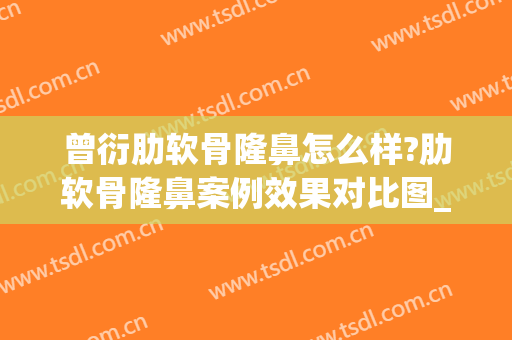 曾衍肋软骨隆鼻怎么样?肋软骨隆鼻案例效果对比图_好大夫工作室(肋软骨隆鼻三年后)