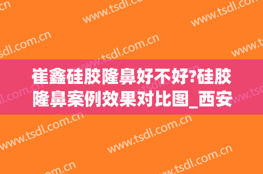 崔鑫硅胶隆鼻好不好?硅胶隆鼻案例效果对比图_西安国际医学中心医院