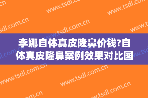 李娜自体真皮隆鼻价钱?自体真皮隆鼻案例效果对比图_许昌市立医院(隆鼻自然款真人实例)