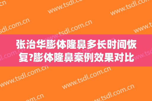 张治华膨体隆鼻多长时间恢复?膨体隆鼻案例效果对比图_苏州市立医院