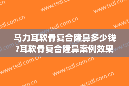 马力耳软骨复合隆鼻多少钱?耳软骨复合隆鼻案例效果对比图_中日友好医院