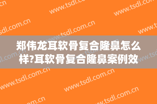 郑伟龙耳软骨复合隆鼻怎么样?耳软骨复合隆鼻案例效果对比图_晋江市医院