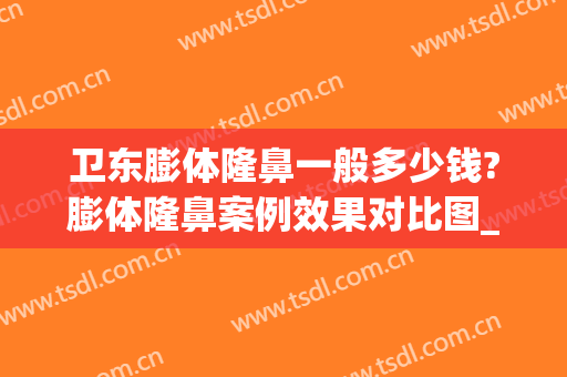 卫东膨体隆鼻一般多少钱?膨体隆鼻案例效果对比图_四川省医学科学院·四川省人民医院