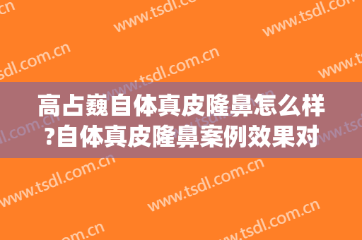 高占巍自体真皮隆鼻怎么样?自体真皮隆鼻案例效果对比图_好大夫工作室